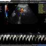 Doppler color Bienestar fetal