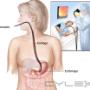 Subido por visitante en 28/04/2016 - ENDOSCOPIA QUE INCLUYE BIOPSIA, INFÓRMATE !!!