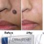 Subido por visitante en 08/03/2016 - dermadent