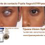 Lente de Pupila Negra
