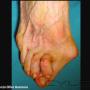 Subido por visitante en 09/10/2015 - evita deformidades tenemos el zapato corecto