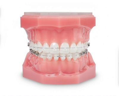 BRACKETS-INVISIBLES