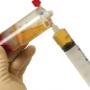 plasma con factores de crecimiento