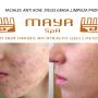 FACIALES ANTI ACNE