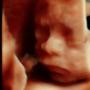Subido por visitante en 16/03/2017
