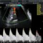 Subido por visitante en 02/04/2017