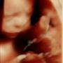 Subido por visitante en 02/04/2017