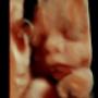 Subido por visitante en 02/04/2017