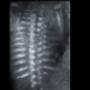 Subido por visitante en 16/03/2017 - Columna fetal