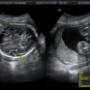 Subido por visitante en 03/08/2016