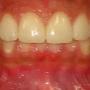 Ortodoncia e implantes dentales en Colima
