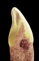 Periodoncia