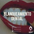 Blanqueamiento Dental