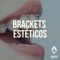 Brackets-Estéticos