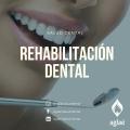 Rehabilitación Dental