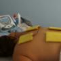 Electroterapia