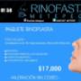Rinoplastia