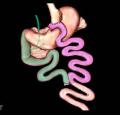 bypass gastrico