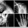 tratamiento de dolor en huesos y articulaciones