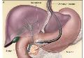 Endoscopia