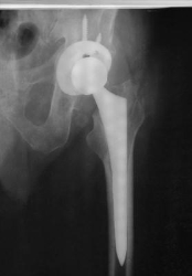 Radiografias a domicilio