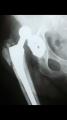radiografias a domicilio