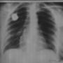 Subido por visitante en 14/03/2017 - Radiografias a domicilio