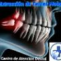 Extracciones