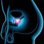 Subido por visitante en 04/05/2016 - Urología
