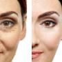 estetica facial