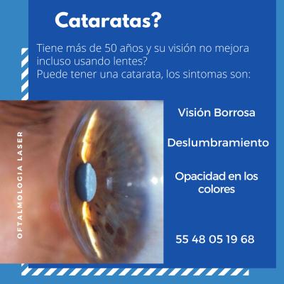 Catarata