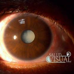 Salud Visual Los Mochis