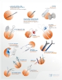 INSUMOS ENDOSCOPIA