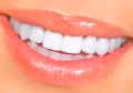 Limpieza-Dental