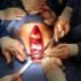 Subido por visitante en 11/07/2016 - Reseccion de Esternon por Osteosarcoma