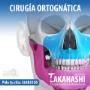 Cirugía maxilofacial