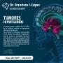 Neurocirugía