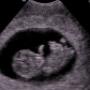 Subido por visitante en 05/08/2016 - Sonografia obstetrica