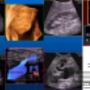 Subido por visitante en 05/08/2016 - Sonografias de alta calidad a precios accesibles