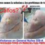 Subido por visitante en 29/06/2018 - Calos y Callosidades