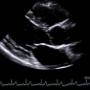 ecocardiogramas