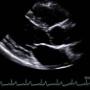 Subido por visitante en 04/04/2017 - Ecocardiograma Guadalajara