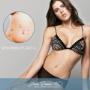 Abdominoplastia