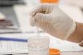 Examen Toxicológico