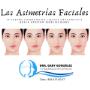 Asimetrias Faciales_ Corrección de Mandíbula Desviada o Mordida Chueca