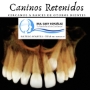 CANINO RETENIDO
