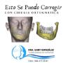 Cirugía Maxilofacial Saltillo Cirugía Ortognática Prognatismo Corrección de Mordida Chueca