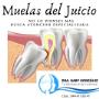 Cirugía Maxilofacial Saltillo Extracción Muelas del Juicio Tercer Molar