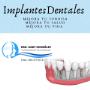 Cirugía Maxilofacial Saltillo Implantes Dentales