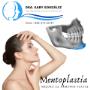 Cirugía Maxilofacial Saltillo_ Mentoplastia_ Ortognática